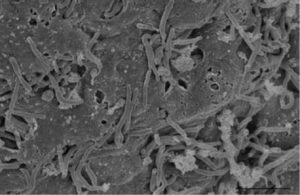 A microscopic image of Candidatus Liberibacter solanacearum.